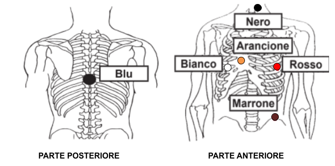 Posizionamento 6 elettrodi Lifecard CF