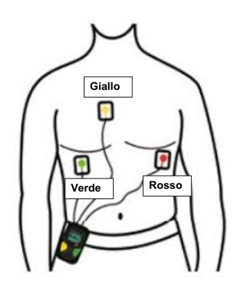 Posizionamento 3 elettrodi Lifecard CF